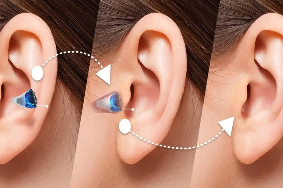 Hearing aid, adult